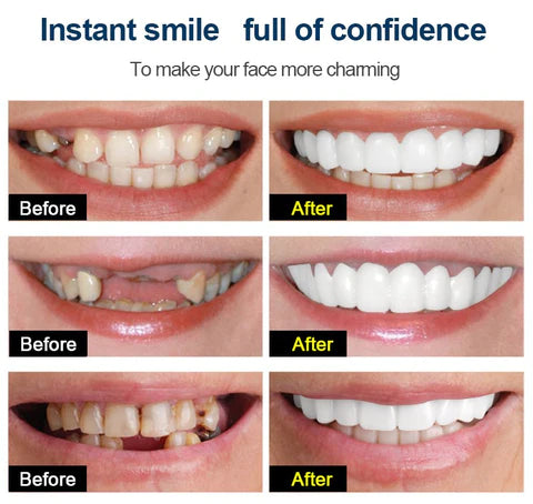Reusable Cosmetic Teeth Cover