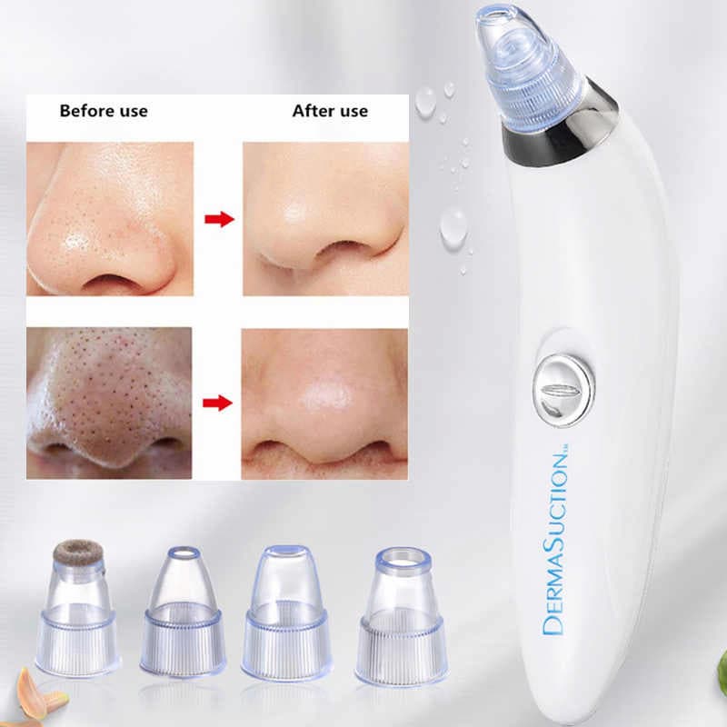 Derma Suction Pore Cleaning Device With Vacuum Action Face Pore Cleaner Facial Beauty Equipment 4 in 1 Black Head Remover